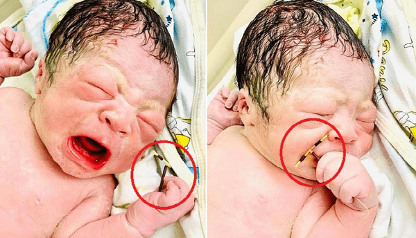 피임기구를 손에 쥐고 태어난 베트남 신생아. / 사진=하이퐁국제병원 공식 페이스북