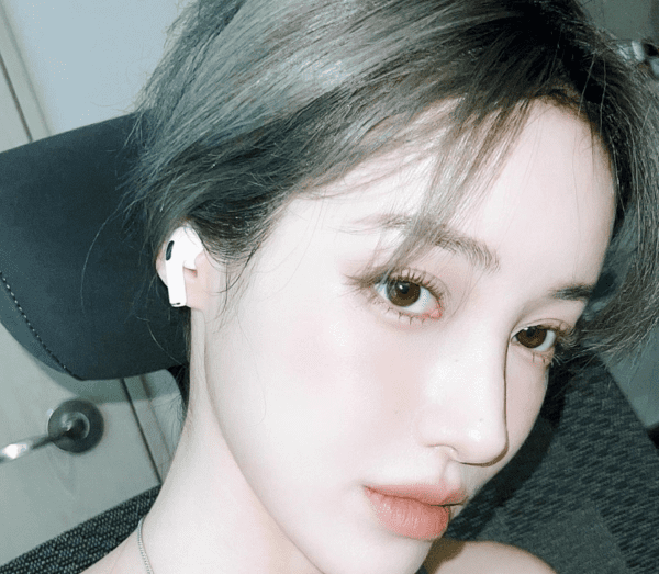 유튜버 유깻잎, 가슴→윤곽 성형 후 달라진 얼굴 공개