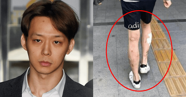 박유천 다리 /사진=온라인 커뮤니티